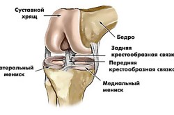 Повреждение менисков коленного сустава
