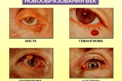 Разновидности заболеваний глаз
